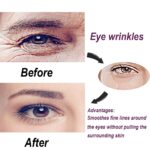 Wrinkle Patches - Image 5