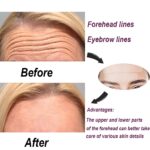 Wrinkle Patches - Image 4