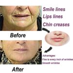 Wrinkle Patches - Image 6